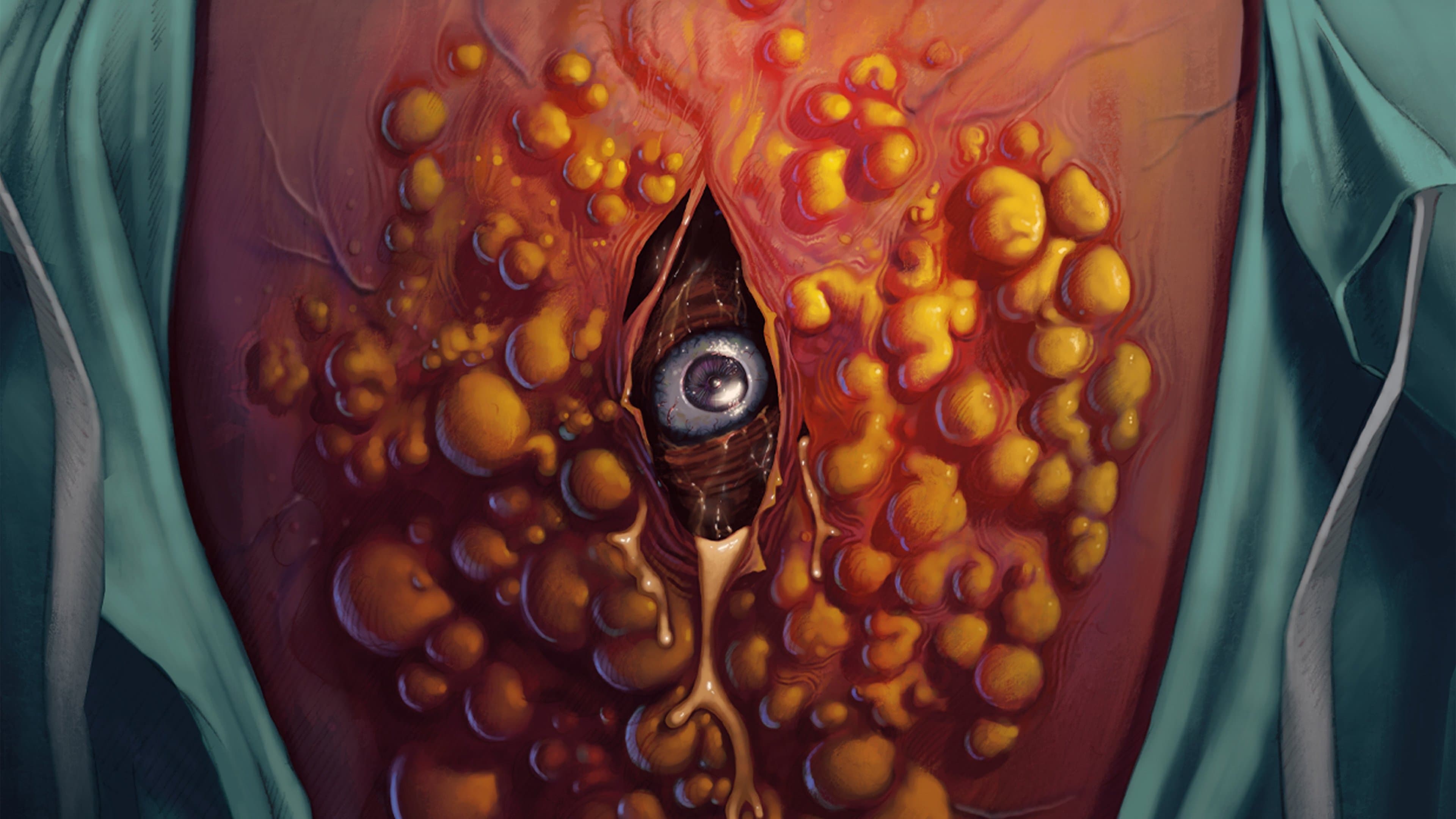 Cyst - La ciste assassina